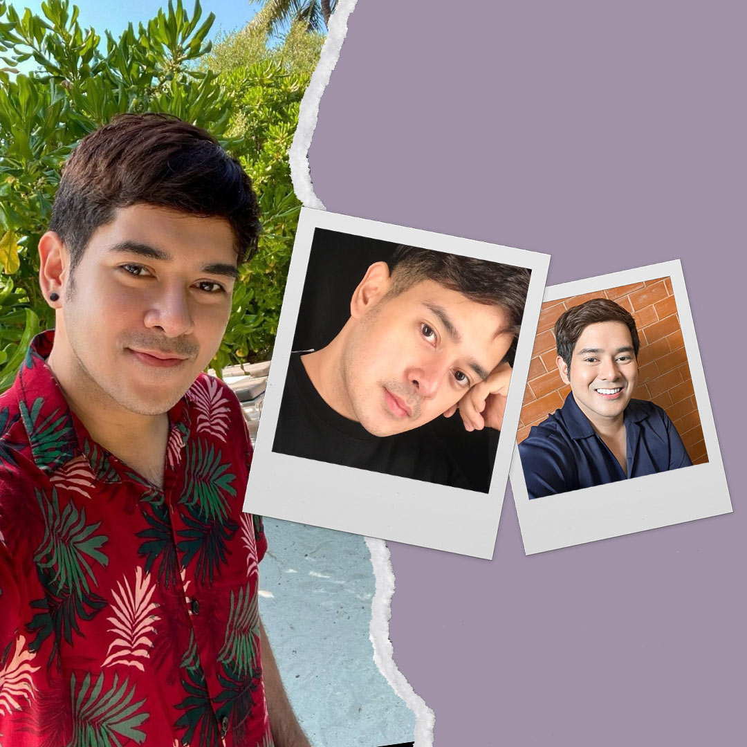 A Dream Fulfilled: JV Cruz Injects the Truth as He Opens Up About Getting Facial Fillers